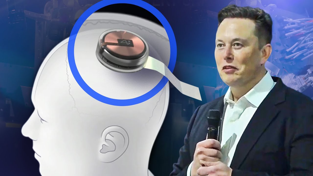 Elon Musk không được cấy chip não lên người