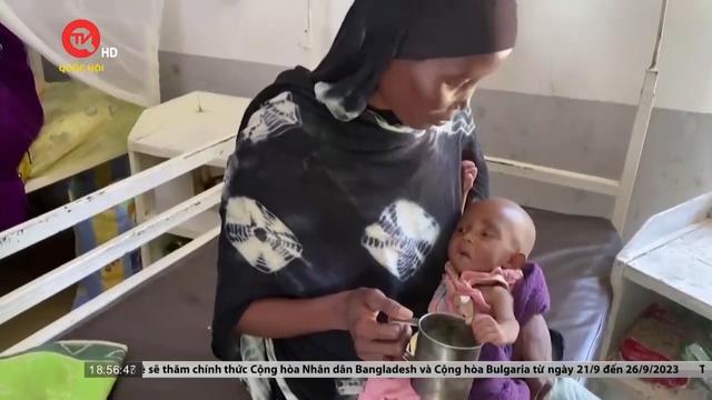 Trẻ em Sudan bị đe dọa bởi dịch sởi và suy dinh dưỡng 