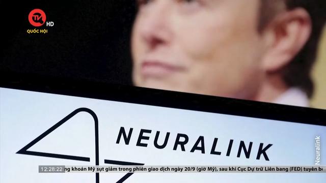 Neuralink thử nghiệm cấy chíp vào não người