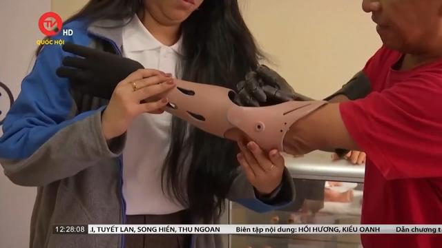 Chân tay giả siêu thực dành cho người khuyết tật tại Bolivia 
