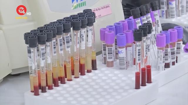 Bộ Y tế: Không cần xét nghiệm "tìm máu đông" sau tiêm vaccine Covid-19