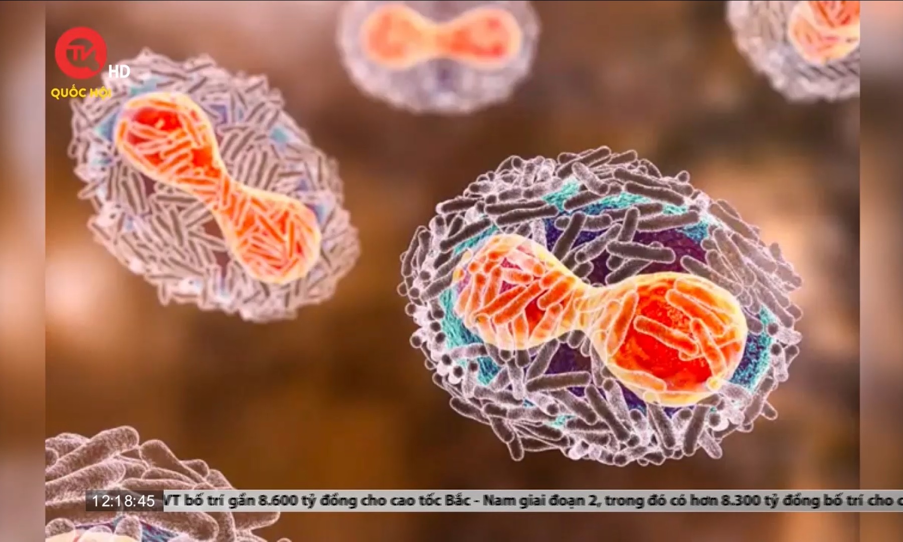 Bệnh nhân đầu tiên mắc đậu mùa khỉ của Việt Nam đã âm tính với virus