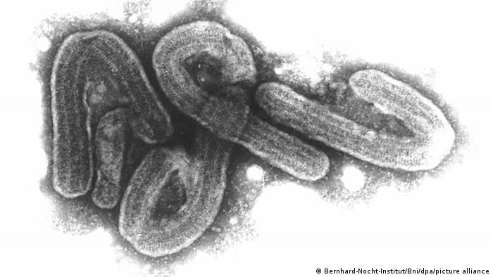 Triệu chứng của virus gây tử vong nhanh ở Châu Phi