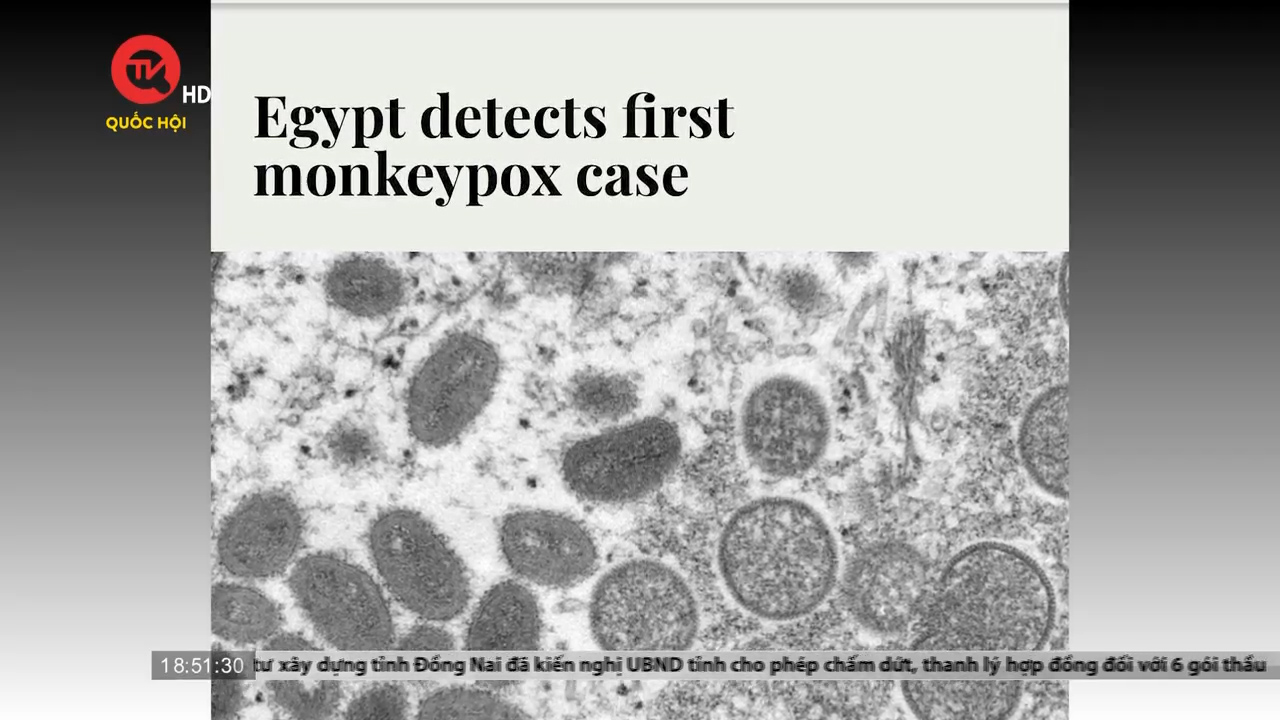 Cụm tin đậu mùa khỉ: Ai Cập phát hiện ca nhiễm đầu tiên